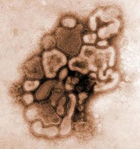Vírus H1N1 de influenza A - crédito: Dr. E. Palmer; R.E. Bates